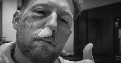 ଅଭ୍ୟାସ ସମୟରେ ଆହତ ହେଲେ ଷ୍ଟୋକ୍ସ