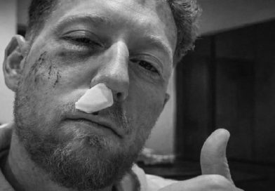 ଅଭ୍ୟାସ ସମୟରେ ଆହତ ହେଲେ ଷ୍ଟୋକ୍ସ